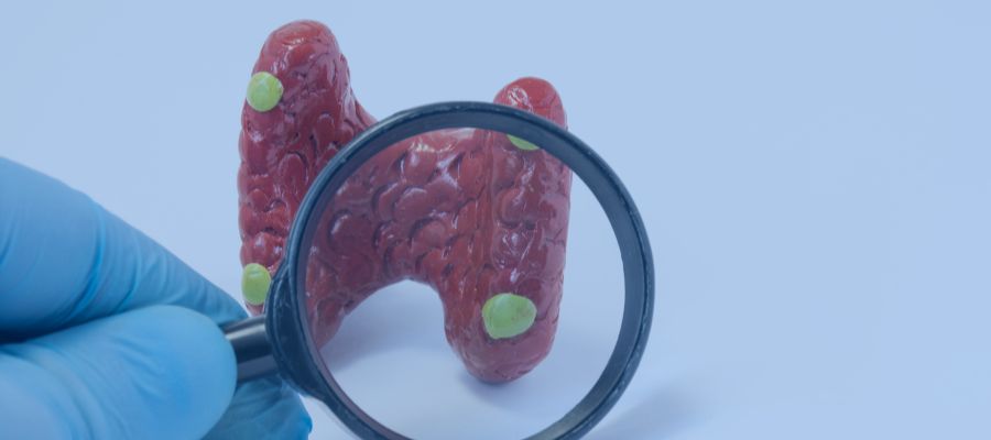 Hiperparatireoidismo Dra Luciana Menta Endocrinologista